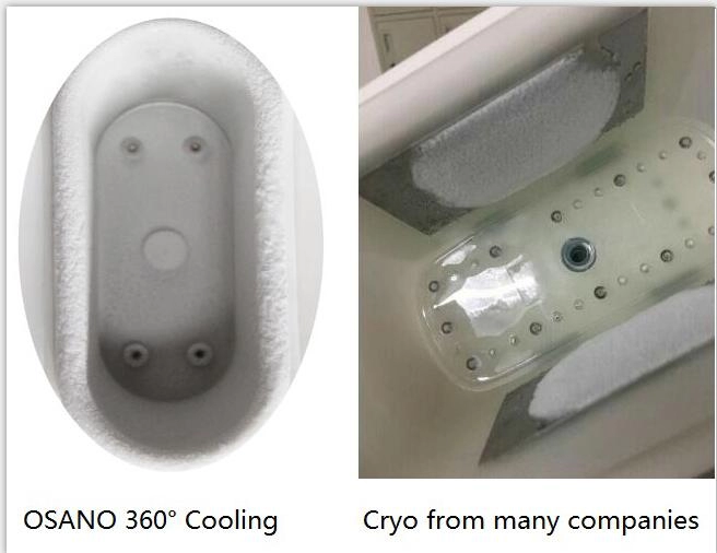 Portable Dual Handle Cryo 360° Weight Loss Slimming Cryotherapy Machine Peralatan Kecantikan